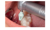TDIA-C-CUPM 1st Step: Medium